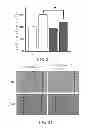 Fig. 19 - METHOD OF THERAPY AND DIAGNOSIS OF ATHEROSCLEROSIS