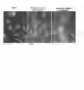 Fig. 02 - Plant-derived elastin binding protein ligands and methods of using the same