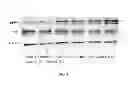 Fig. 03 - Methods and Compositions for Maintaining Blood-Brain Barrier Integrity
