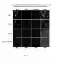 Fig. 09 - Methods and Compositions for Maintaining Blood-Brain Barrier Integrity