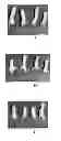 Fig. 01 - Composition for providing Wear Resistance to a Surface