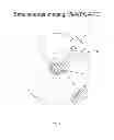 Fig. 04 - Intensity modulated arc therapy with continuous coach rotation/shift and simultaneous cone beam imaging