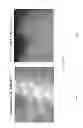 Fig. 06 - Intensity modulated arc therapy with continuous coach rotation/shift and simultaneous cone beam imaging