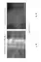 Fig. 07 - Intensity modulated arc therapy with continuous coach rotation/shift and simultaneous cone beam imaging