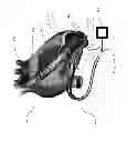 Fig. 02 - VAD integrated flow sensor