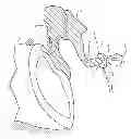 Fig. 01 - Implantable microphone for hearing systems