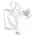 Fig. 02 - Implantable microphone for hearing systems