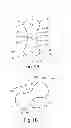 Fig. 02 - Pessary device
