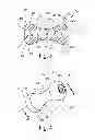 Fig. 04 - Pessary device
