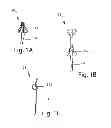 Fig. 02 - Intravaginal device withdrawal assembly