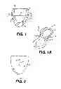 Fig. 02 - Transventricular implant tools and devices