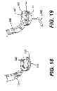 Fig. 09 - Transventricular implant tools and devices