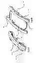Fig. 06 - ENDOSCOPIC FULL THICKNESS RESECTION USING SURGICAL COMPRESSION CLIPS