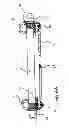 Fig. 08 - ENDOSCOPIC FULL THICKNESS RESECTION USING SURGICAL COMPRESSION CLIPS