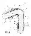 Fig. 03 - APPLICATOR, ASSEMBLY, AND METHOD FOR CONNECTING AN INLET CONDUIT TO A HOLLOW ORGAN
