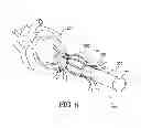 Fig. 07 - APPLICATOR, ASSEMBLY, AND METHOD FOR CONNECTING AN INLET CONDUIT TO A HOLLOW ORGAN