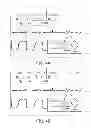 Fig. 05 - Defibrillator including light sensor