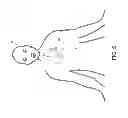Fig. 06 - Defibrillator including light sensor
