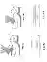Fig. 09 - Defibrillator including light sensor