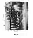 Fig. 28 - System and method for instant and automatic border detection