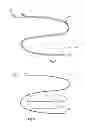 Fig. 02 - Catheter locator apparatus and method of use