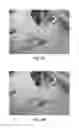 Fig. 09 - METHODS FOR LOCALIZING IMPLANTED VASCULAR ACCESS DEVICES