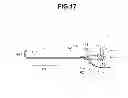 Fig. 12 - Probe and endoscope