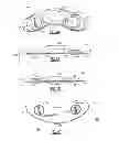 Fig. 02 - Body worn physiological sensor device having a disposable electrode module