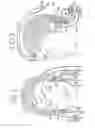 Fig. 03 - NON-INVASIVE, BEDSIDE INTRA-CRANIAL PRESSURE AND BRAIN SHIFT/HERNIATION MONITORING UNIT UTILIZING EARLY ON-SET AUDITORY EVOKED RESPONSES