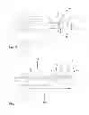 Fig. 03 - Lancing device for taking blood samples