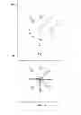 Fig. 12 - System and method to facilitate analysis of brain injuries and disorders