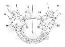 Fig. 01 - Speech therapy device