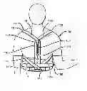 Fig. 01 - Hyperextension Brace
