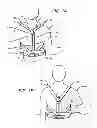 Fig. 02 - Hyperextension Brace