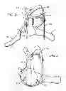 Fig. 03 - Hyperextension Brace