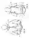 Fig. 05 - Hyperextension Brace