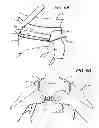 Fig. 06 - Hyperextension Brace
