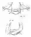 Fig. 08 - Hyperextension Brace