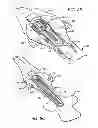 Fig. 10 - Hyperextension Brace