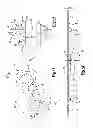 Fig. 02 - NOVEL PRESSURE EQUALIZATION TUBE