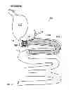 Fig. 01 - Methods and apparatus for anchoring within the gastrointestinal tract
