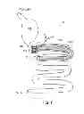 Fig. 07 - Methods and apparatus for anchoring within the gastrointestinal tract