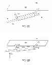 Fig. 10 - Methods and apparatus for anchoring within the gastrointestinal tract