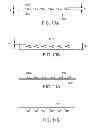 Fig. 12 - Methods and apparatus for anchoring within the gastrointestinal tract