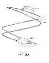 Fig. 16 - Methods and apparatus for anchoring within the gastrointestinal tract