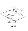 Fig. 17 - Methods and apparatus for anchoring within the gastrointestinal tract