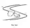 Fig. 18 - Methods and apparatus for anchoring within the gastrointestinal tract