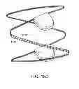 Fig. 19 - Methods and apparatus for anchoring within the gastrointestinal tract
