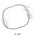 Fig. 20 - Methods and apparatus for anchoring within the gastrointestinal tract