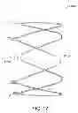 Fig. 22 - Methods and apparatus for anchoring within the gastrointestinal tract